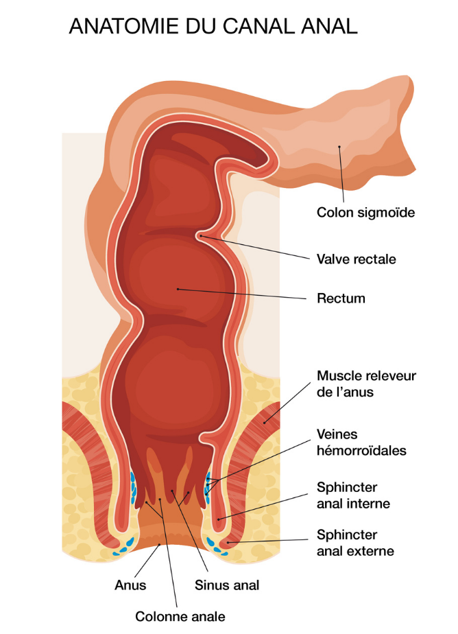 Hémorroïdes internes - Coloproctologie